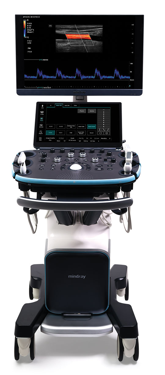 Mindray Resona I9 характеристики и применение